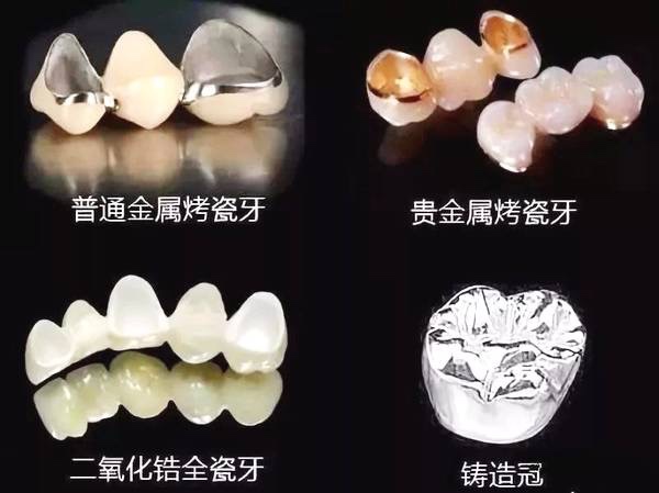 常德美奧口腔鉅惠看牙,韓國登騰種植牙3980元起,自鎖托槽矯正享5折優(yōu)惠！