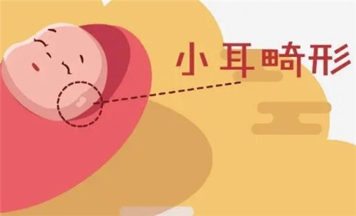 【河南中醫(yī)藥大學(xué)一附院】莊洪興教授暑假坐診，耳畸形修復(fù)限時預(yù)約！