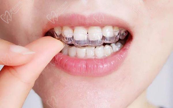 網(wǎng)購牙套戴出問題了怎么辦？