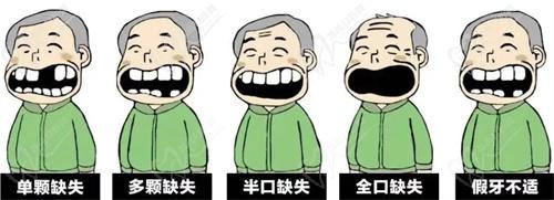 杭州種植牙哪家醫(yī)院好？
