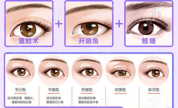 西安雙眼皮孫峰