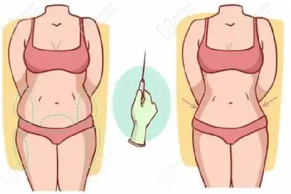 賀天遙自體脂肪填充臀部好看嗎？國(guó)內(nèi)豐臀前十醫(yī)生在北京禾美嘉豐臀過(guò)的口碑都說(shuō)好