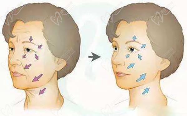 沈陽(yáng)筋膜提升哪家醫(yī)院好？2025年沈陽(yáng)地區(qū)筋膜提升醫(yī)院排名前十及特色介紹