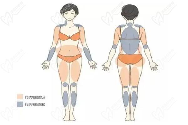 哈爾濱羽禪醫(yī)美楊宇梓做腰腹環(huán)吸怎么樣？口碑技術(shù)靠譜價格實惠看吸脂優(yōu)勢